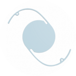 Scleral Fixation IOL